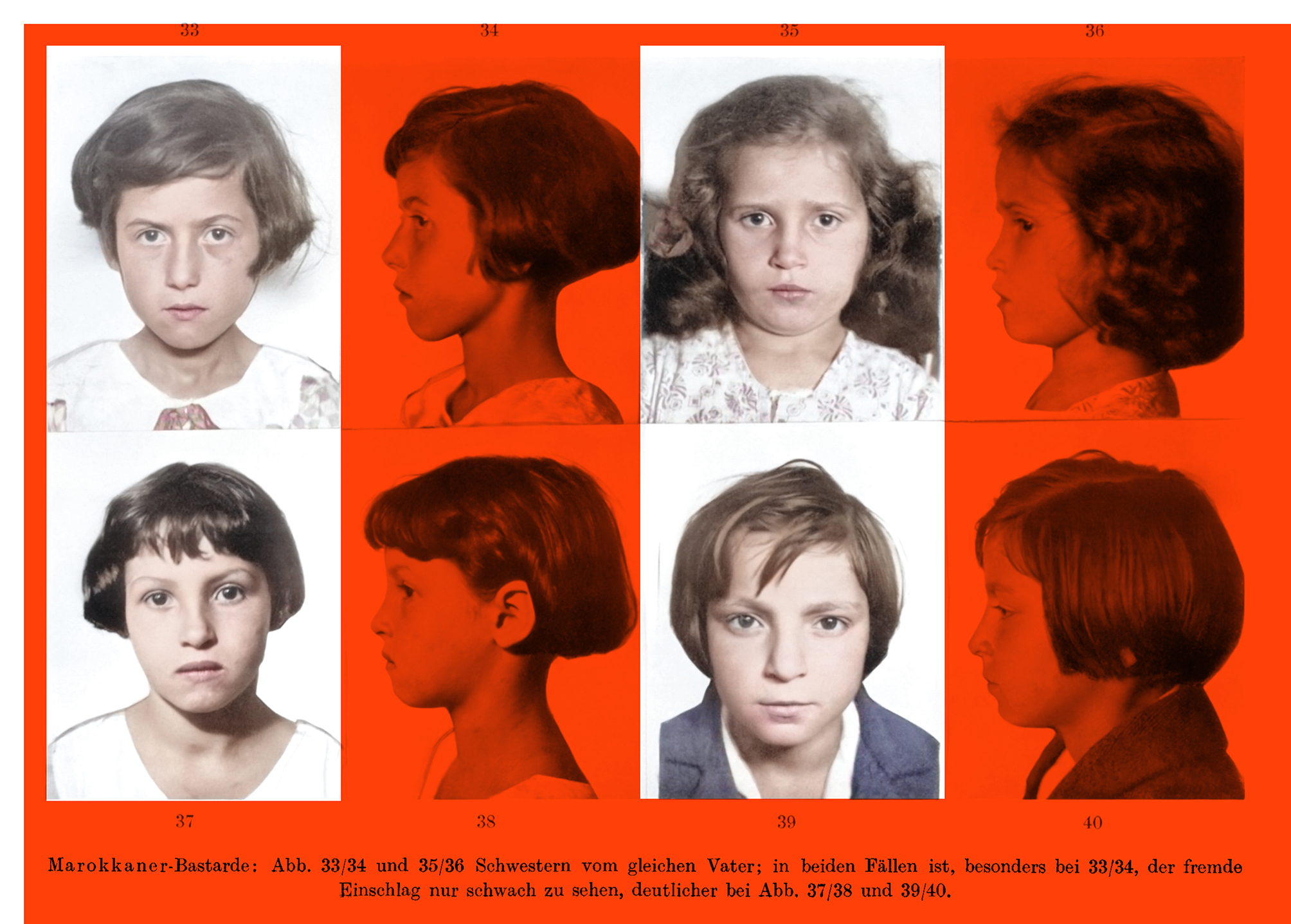 This image has eight black-and-white photographs showing the heads of four children. Each of the children is pictured from the front and from the side.